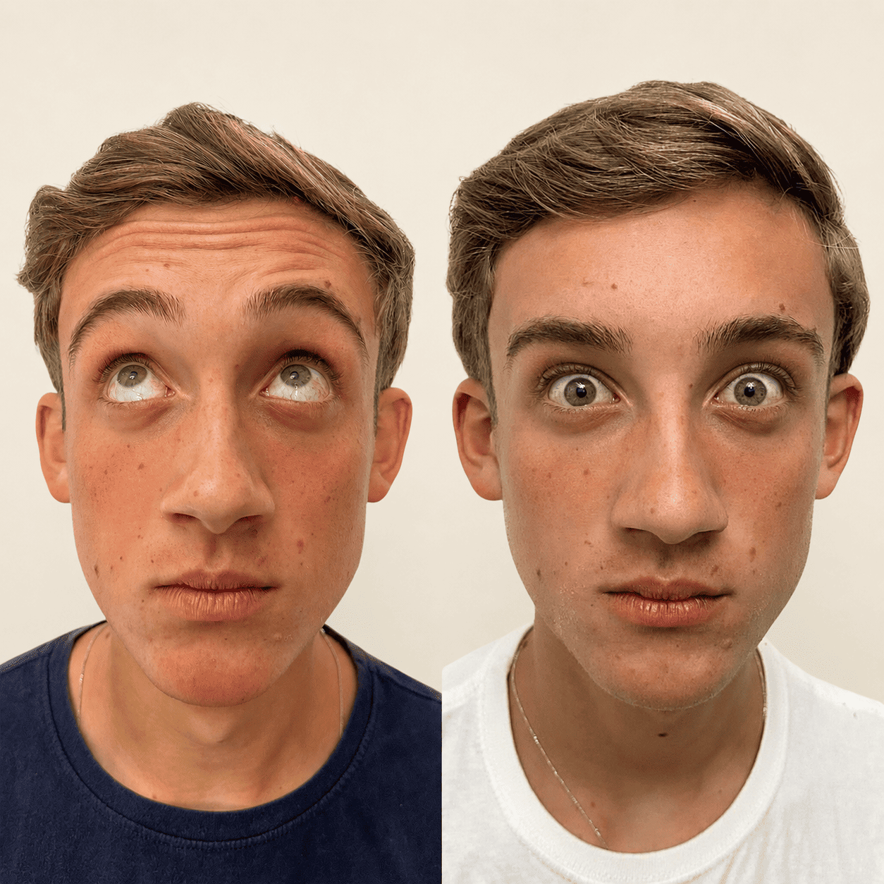 Antes e depois 7