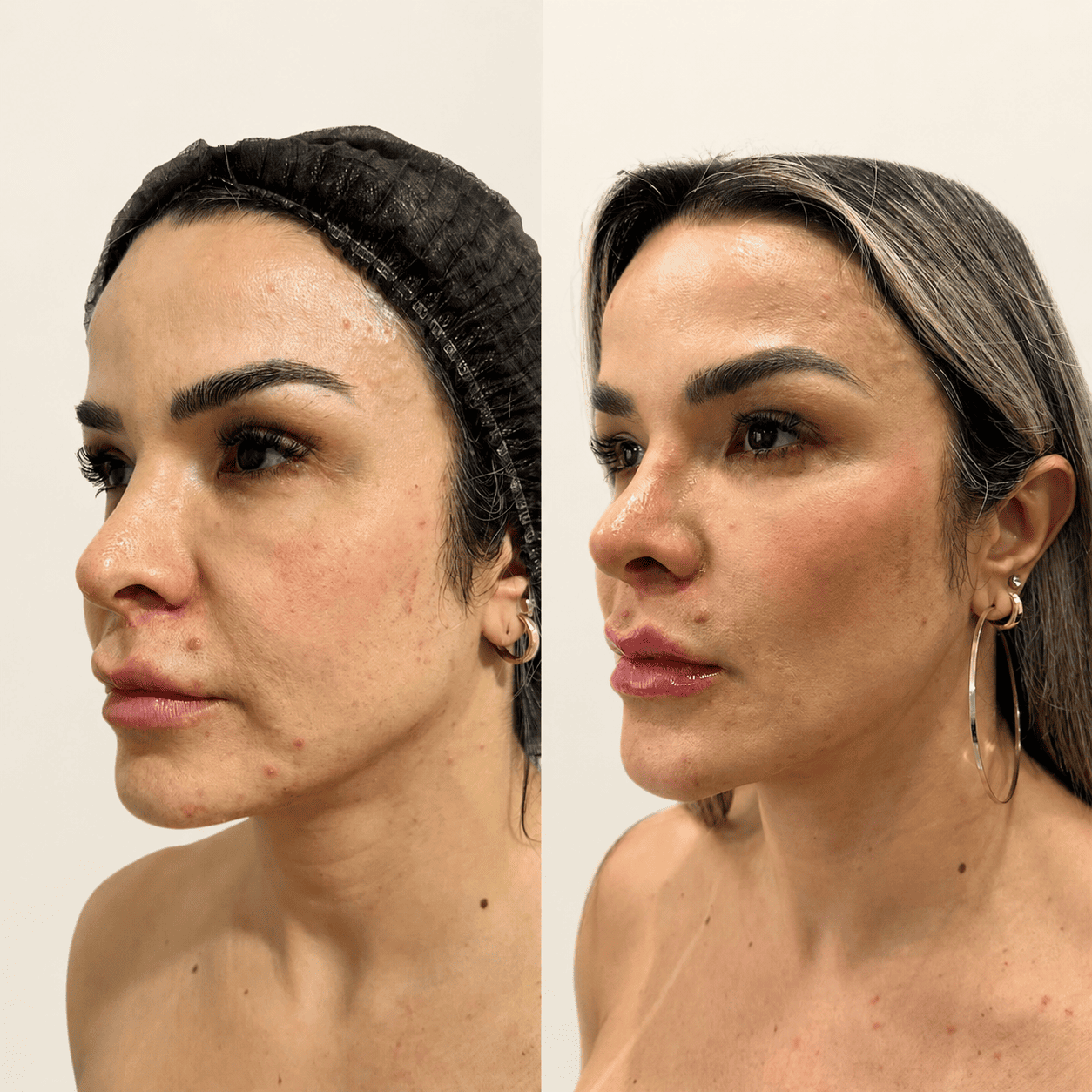 Antes e depois 1